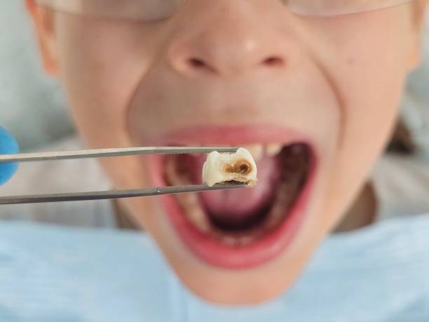 Best Orthodontic Emergency Dentist in Eagleton Village, TN