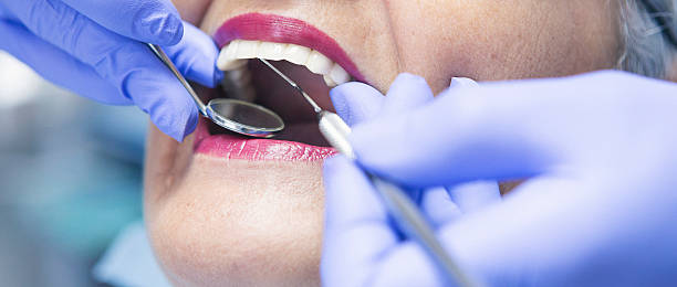 Best Emergency Dentist for Lost Fillings or Crowns in Eagleton Village, TN